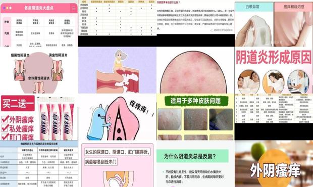 汕头外阴痒是什么妇科炎症