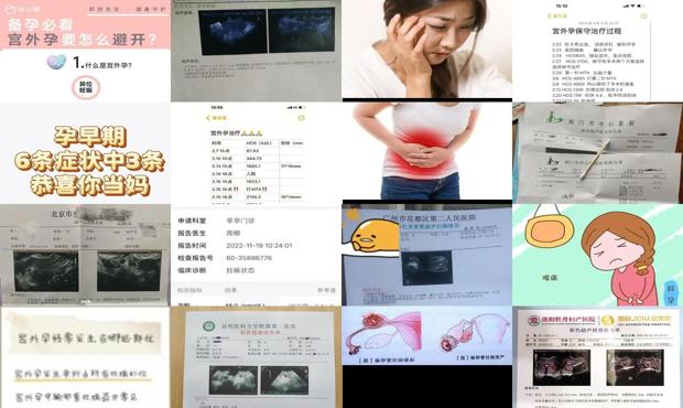 宫外怀孕10天最明显的征兆 - 汕头宫外孕10天早期症状