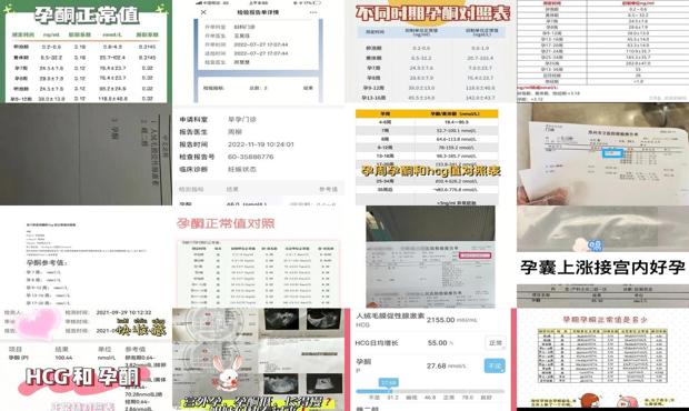 孕酮在多少算正常 - 汕头孕酮多少是宫外孕