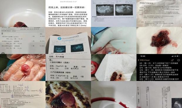 汕头50天药流的亲身经历