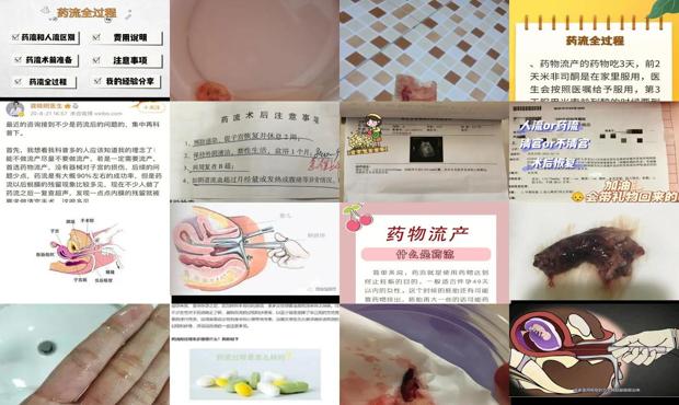 汕头药流是怎样的一个过程