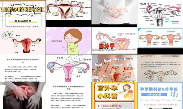 宫外怀孕大概要多少钱 - 汕头宫外孕的早期症状