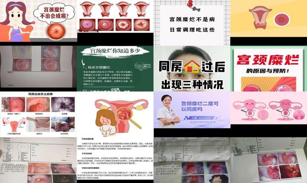 汕头宫颈糜烂能同房吗