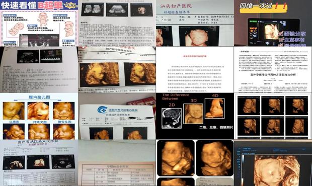 宫外孕怎么治疗 - 汕头宫外孕怎么治疗最好