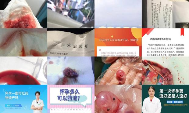 汕头怀孕40多天可以药流吗