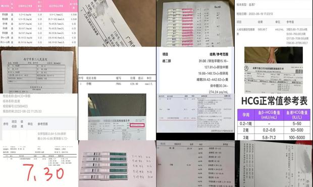 宫外孕查血数值是多少 - 汕头宫外孕血hcg值