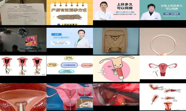 汕头有妇科炎症能上环吗