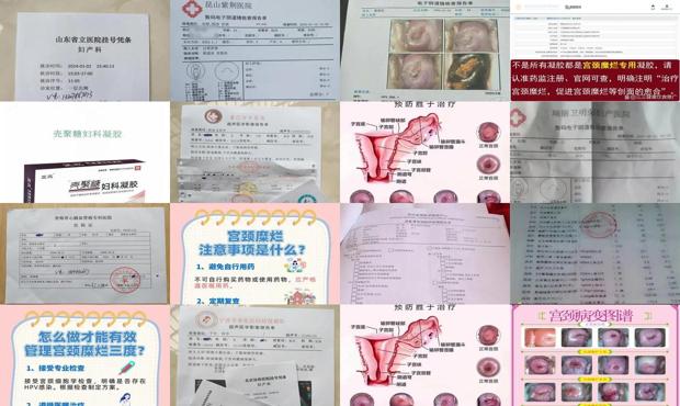 汕头宫颈糜烂3度手术价格
