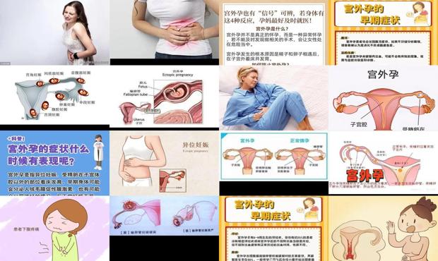 宫外孕会生出来吗 - 汕头宫外孕会有什么症状出现