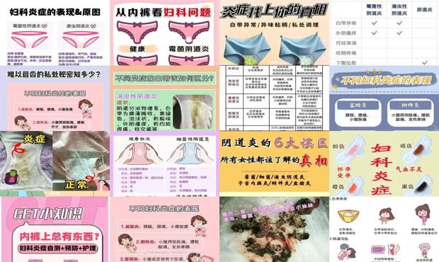 汕头妇科炎症六大表现图片