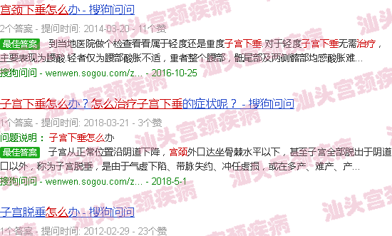 汕头宫颈下垂怎么治疗