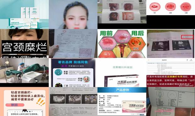 汕头宫颈糜烂治疗费用 - 汕头宫颈糜烂治疗要多少钱