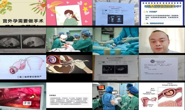 汕头宫外孕哪个医院好 - 汕头请问宫外孕流产了还需要做手术吗
