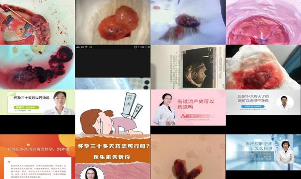 怀孕三十天能打掉吗 - 汕头怀孕三十天可以药流吗
