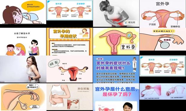 怀孕初期宫腔有积液怎么办 - 汕头怀孕初期宫外孕有什么症状