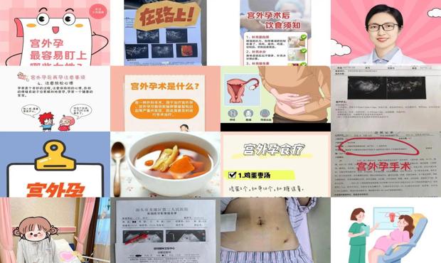 汕头宫外孕术后注意事项