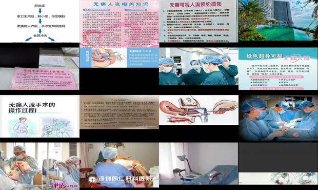 汕尾无痛人流多少钱 - 汕头无痛人流过程图