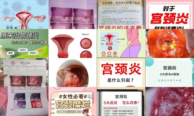 汕头宫颈炎严重吗