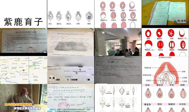 汕头医院检查处女膜