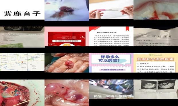 怀孕10多天怎么处理 - 汕头怀孕十多天可以药流吗