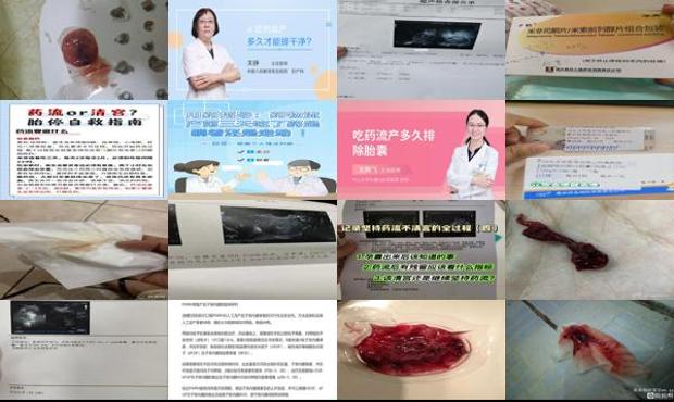汕头用药流产多久能掉下来