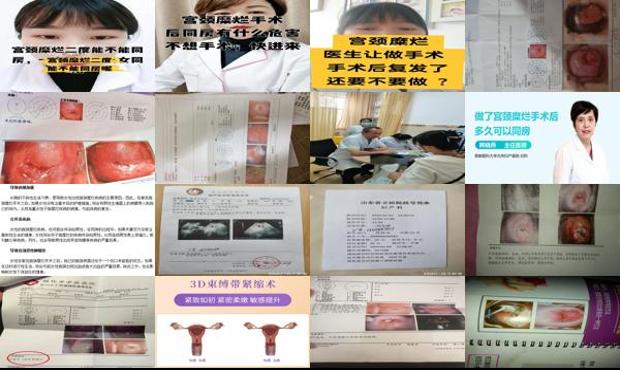 汕头做宫颈糜烂手术后多久可以同房