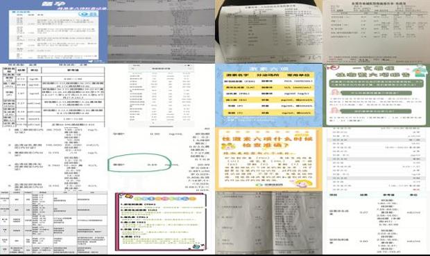 汕头性激素检查怎么查