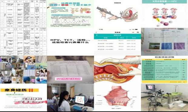 汕头宫颈检查包括哪些