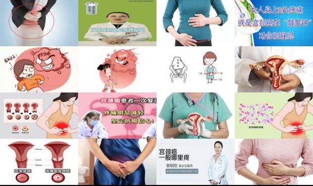 宫劲癌医院 - 汕头宫颈癌一般哪里疼