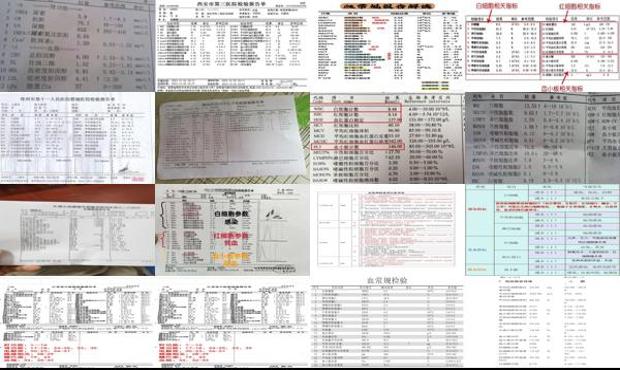 汕头血常规检查费用多少 - 汕头血常规检查项目