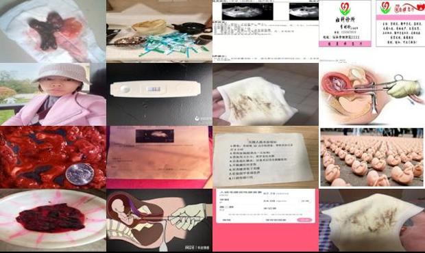 汕头四个月可以药流吗