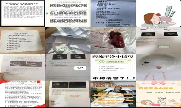 药流没干净的话会怀孕吗 - 汕头药流没干净怎么办