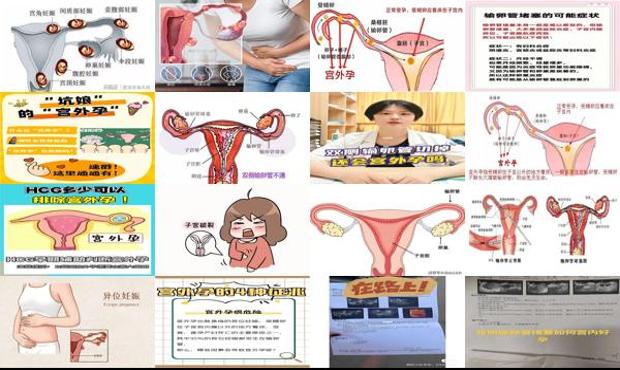 双侧输卵管怎么治疗 - 汕头双侧输卵管堵塞怀孕会宫外孕吗