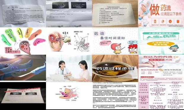汕头药流和打胎的价格 - 汕头药流什么时候做最好