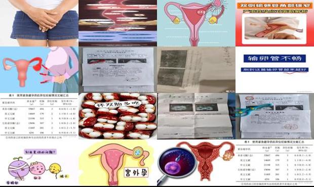 汕头精神卫生中心医院 - 汕头精子活力低会导致宫外孕吗