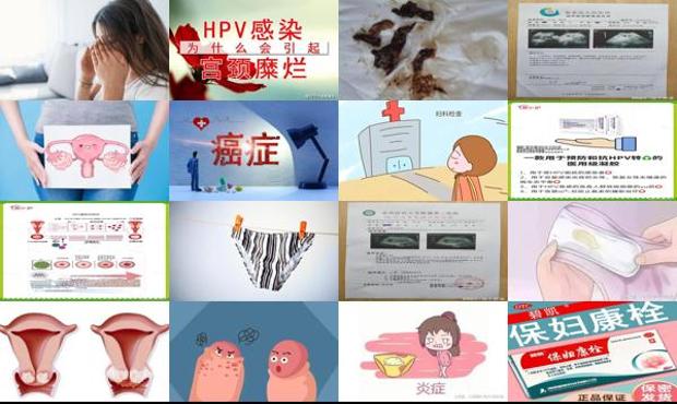 汕头宫颈糜烂的分泌物图片