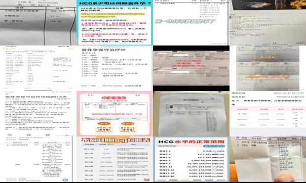 汕头宫外孕流产费用 - 汕头宫外孕hcg是多少