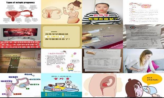 怀宫外孕的几率是多少 - 汕头怀宫外孕有什么症状