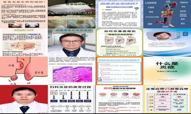 妇科炎症是去妇科医院还是综合性医院 - 汕头妇科炎症是怎样形成的
