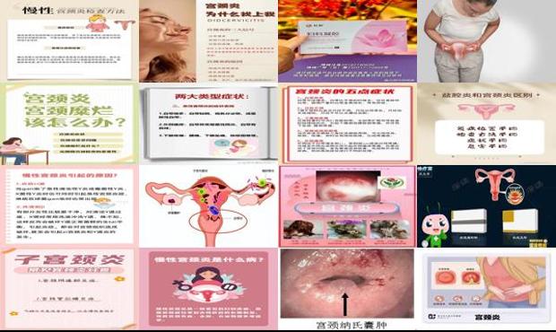 宫颈炎医生 - 汕头宫颈炎宫颈