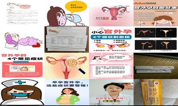 汕头中心医院宫外孕手术多少钱 - 汕头一个月宫外孕的症状