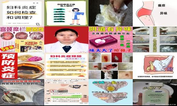 汕头妇科炎症有异味