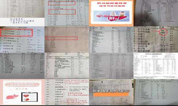 汕头肝病专科医院地址 - 汕头肝功能检查