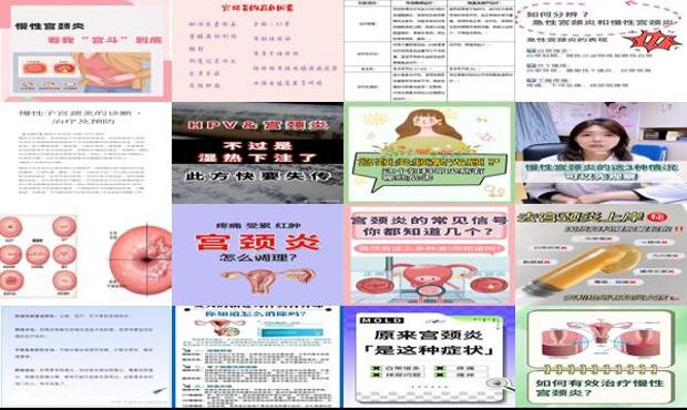 汕头怎样治疗慢性宫颈炎