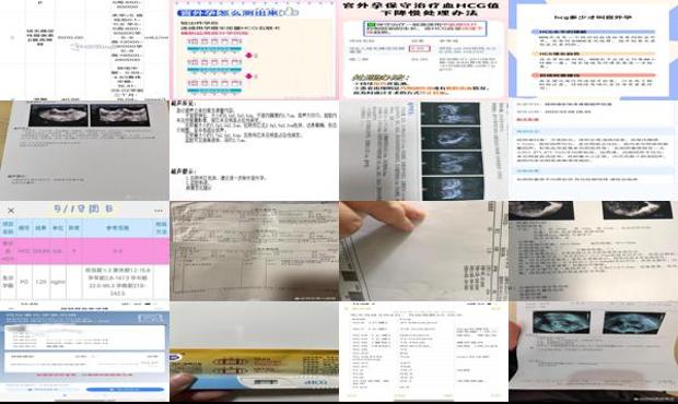 查hcg可以确定怀孕吗 - 汕头hcg能查出宫外孕吗