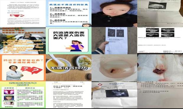 流产药流不干净 - 汕头药流不干净清宫会疼吗