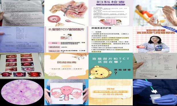汕头宫颈刮片是检查什么