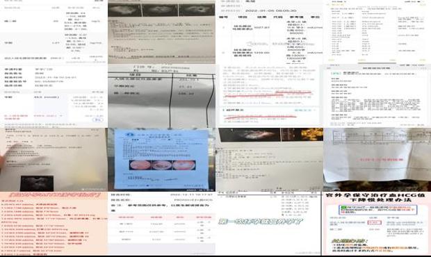宫外怀孕检测 - 汕头查出宫外孕 hcg4000需要手术吗