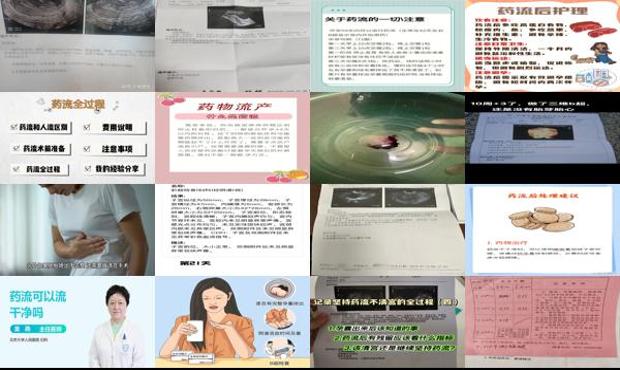 药流产怎么做 - 汕头药流后怎样才算流干净