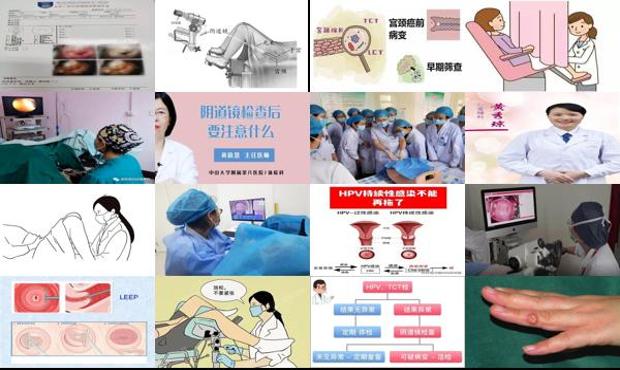 汕头附一妇科检查费用 - 汕头做阴道镜检查疼吗